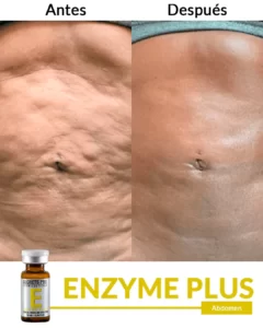 Inicio 23 Abdomen-1