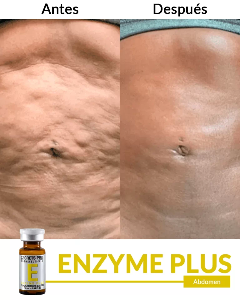 Productos 34 Abdomen-1