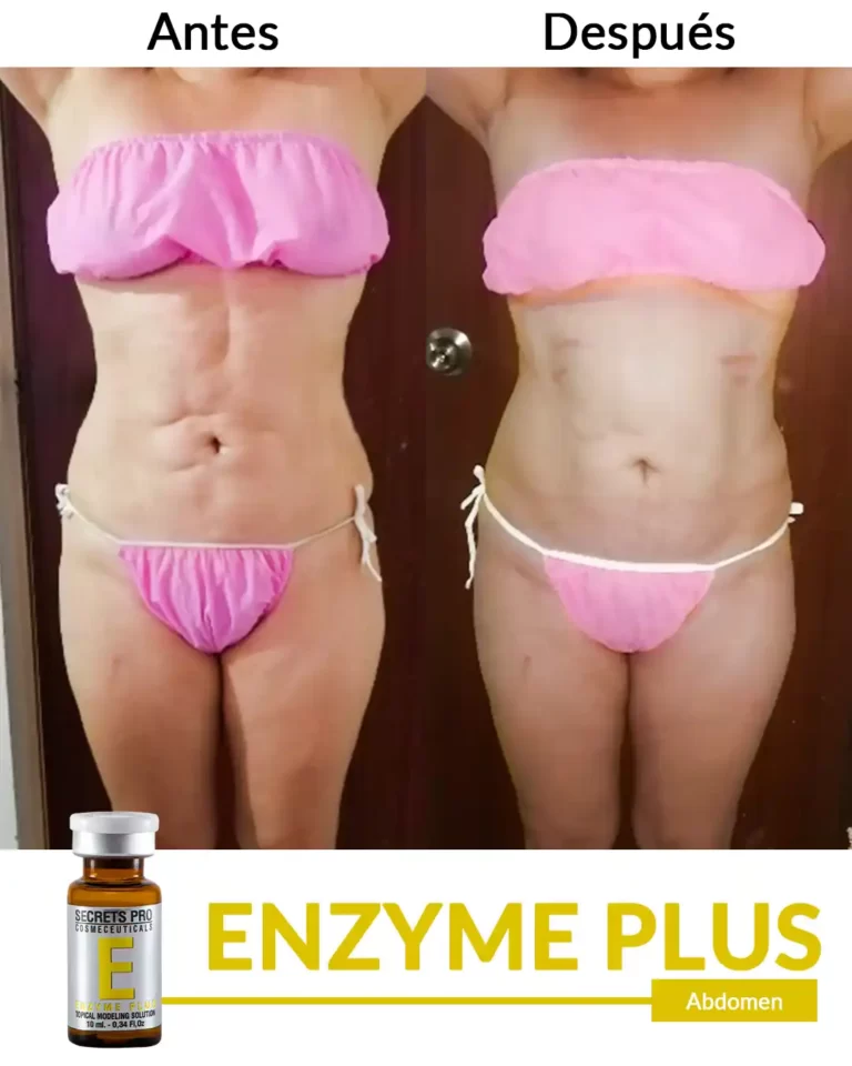 Productos 41 Abdomen (1)