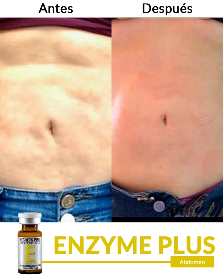 Productos 52 Abdomen-2