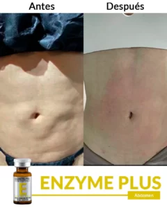 Inicio 15 Abdomen-3