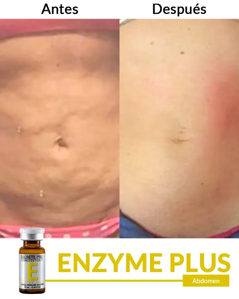 Productos 16 Abdomen-4