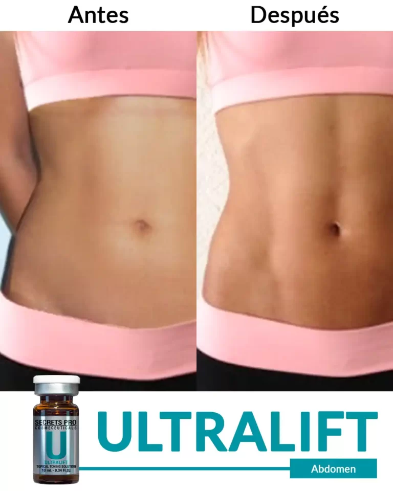 Productos 42 Abdomen