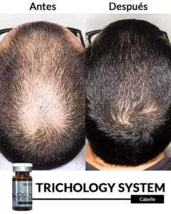 Inicio 19 Cabello 1
