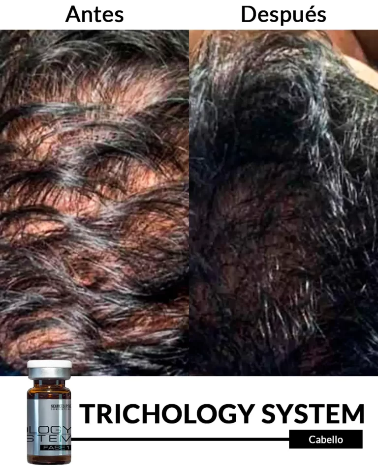 Productos 43 Cabello-_-_