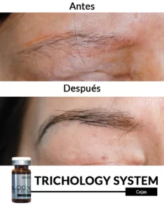 Inicio 7 Cejas