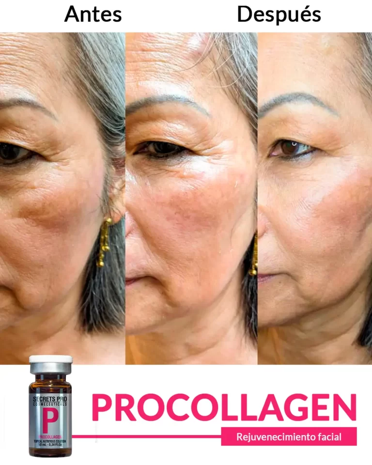 Productos 55 Rejuvenecimiento-facial