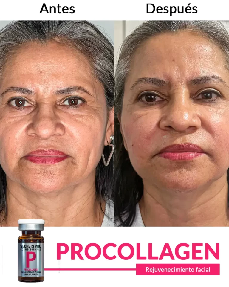 Productos 50 Rejuvenecimiento-facial_