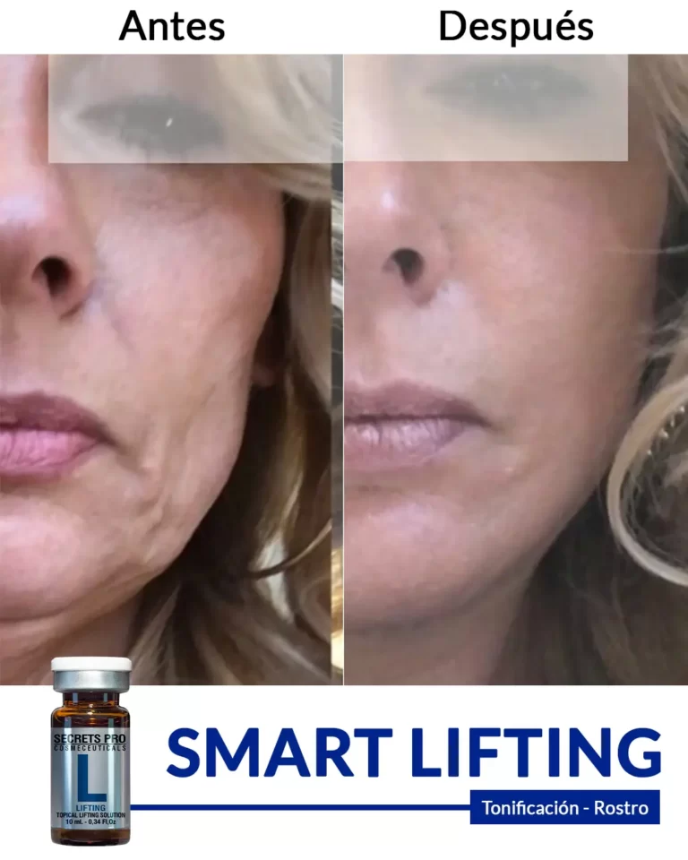 Productos 51 SMART-LIFTING-tonificación-de-restro-3