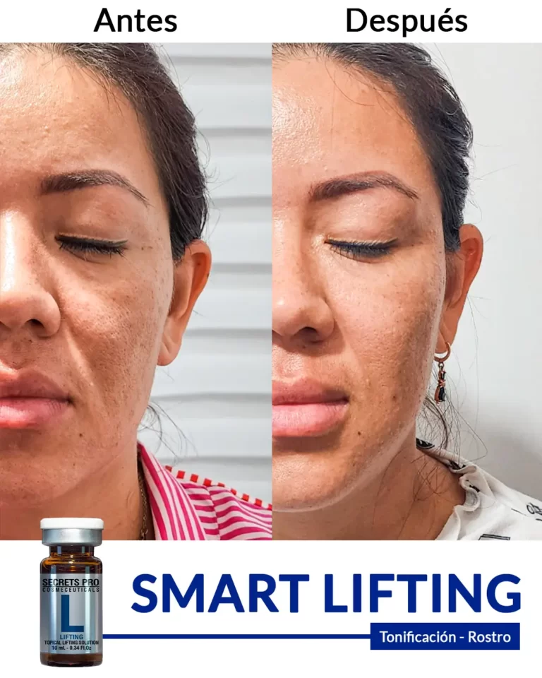 Productos 33 SMART-LIFTING-tonificación-de-rostro-2