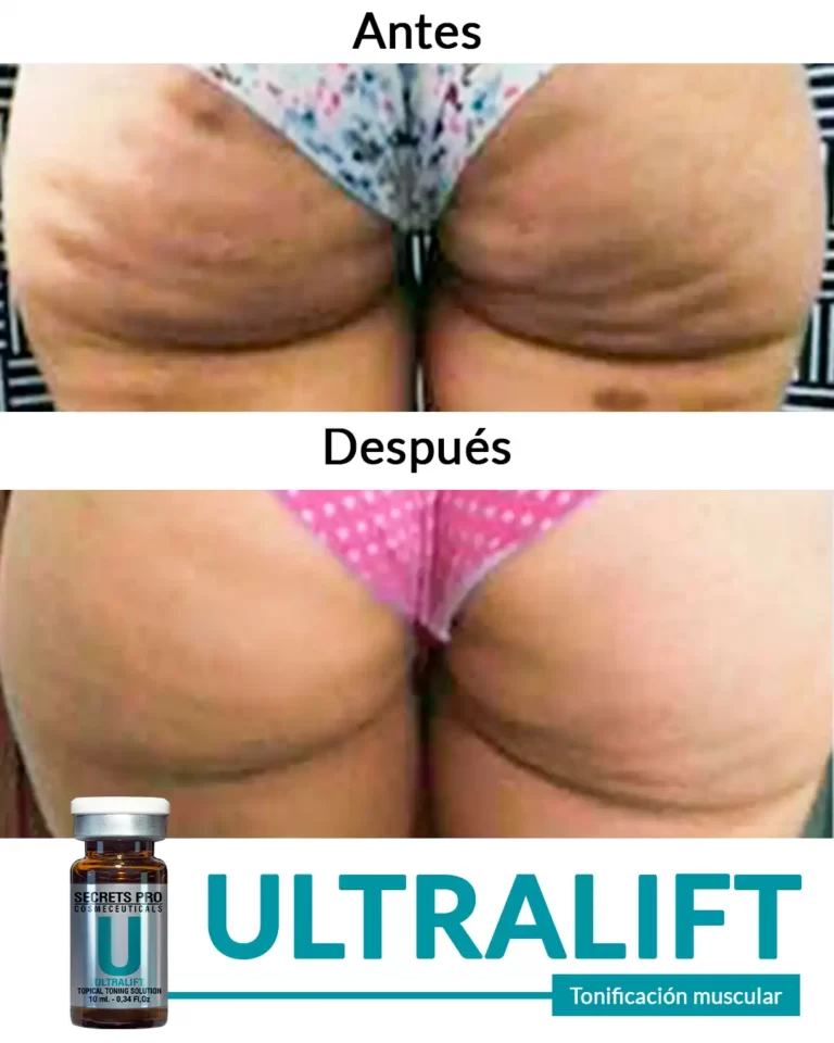 Productos 19 Tonificación-muscular-_-_