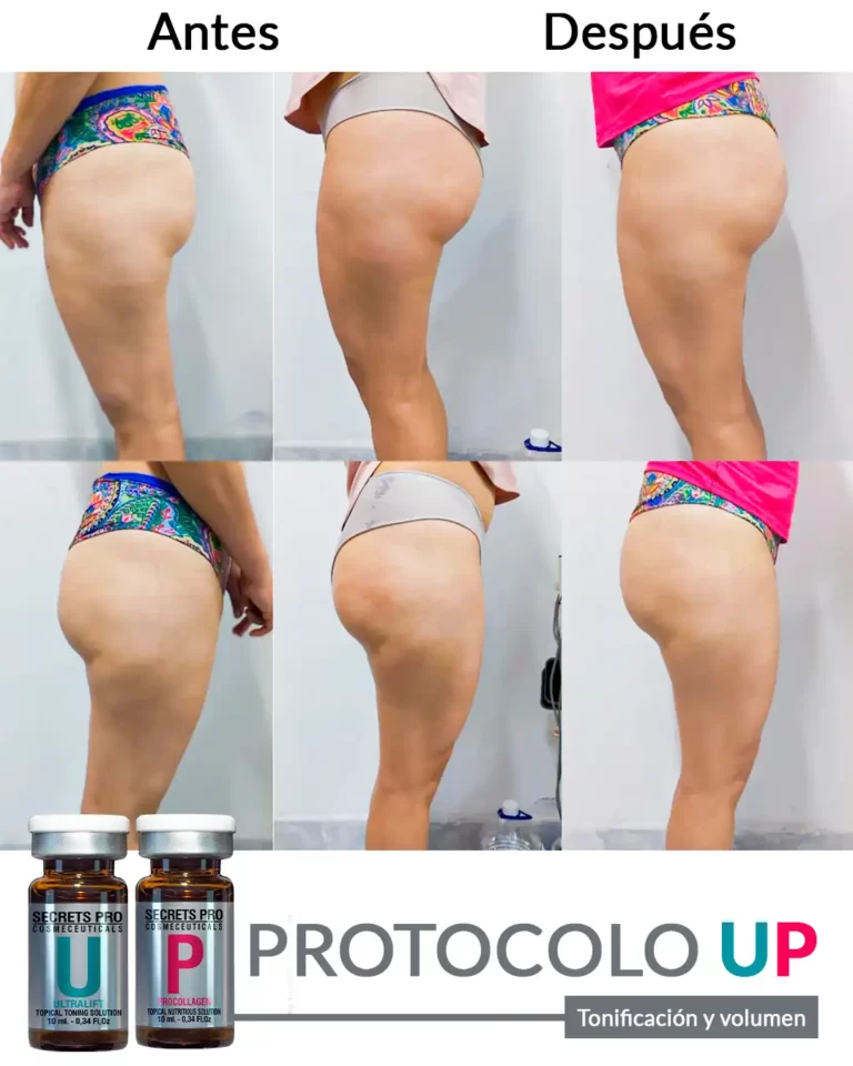 Productos 28 Tonificación-y-volumen_