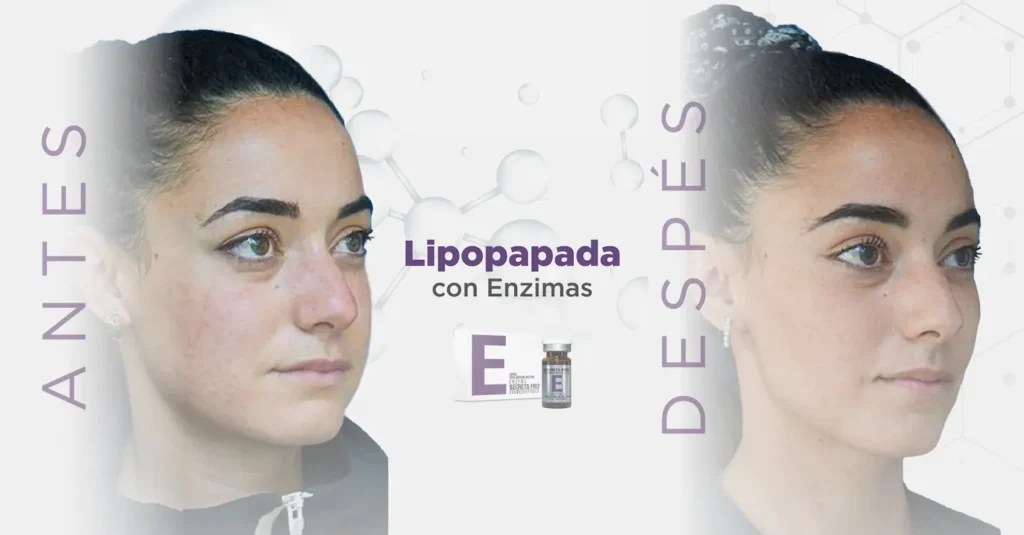Lipopapada Redefiniendo el Rostro 2 Imagenes Blog Web 3