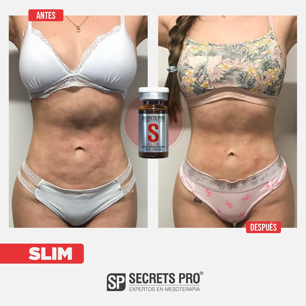 S - SLIM 6 Antes y Despues Junio 2024_S 3