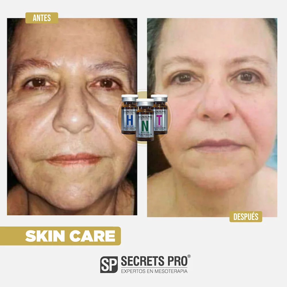 SC - SKIN CARE 4 Antes y Despues Junio 2024_SC