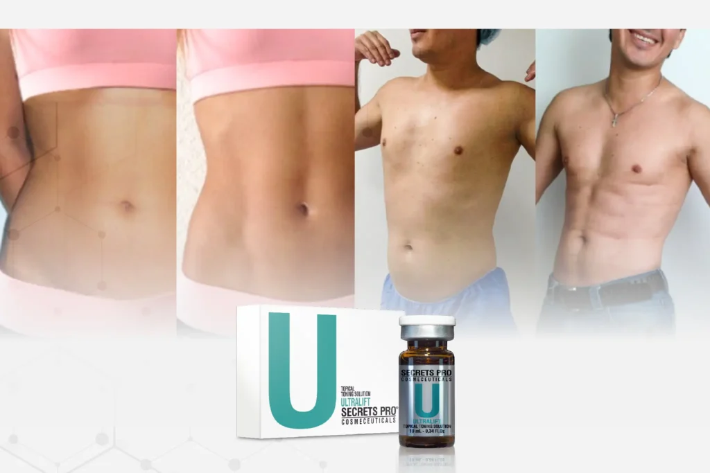 ULTRALIFT: El Cóctel de Principios Activos que Revoluciona la Mesoterapia 2 Piezas Tienda SecretsPro AyD 7