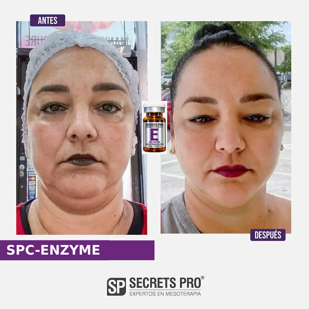 Evidencias 15 Registro de antes y después asociado a SPC-ENZYME, caso 15