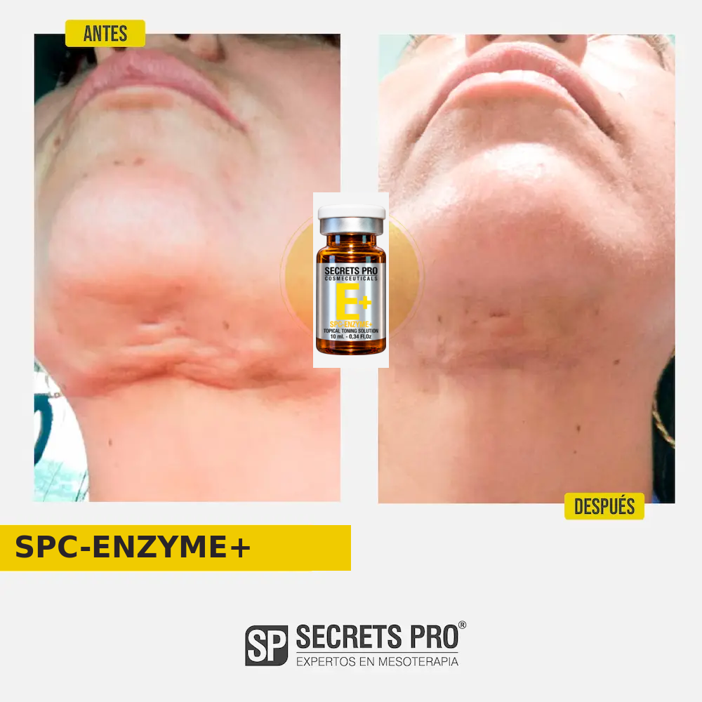Registro de antes y después asociado a SPC-ENZYME+, caso 26