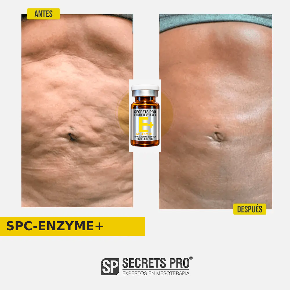 Evidencias 27 Registro de antes y después asociado a SPC-ENZYME+, caso 27