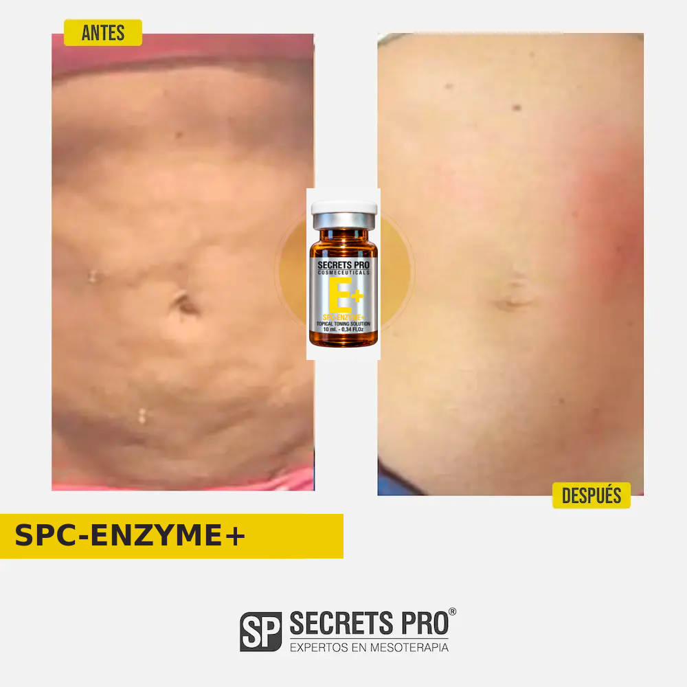 Evidencias 28 Registro de antes y después asociado a SPC-ENZYME+, caso 28