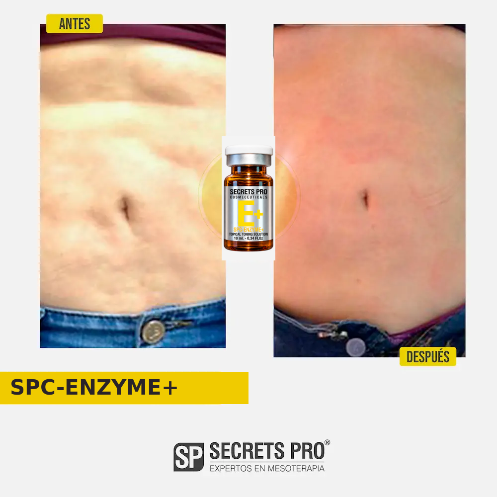 Evidencias 29 Registro de antes y después asociado a SPC-ENZYME+, caso 29