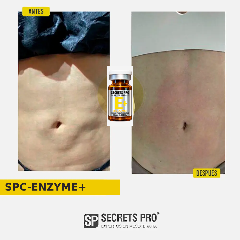 Evidencias 30 Registro de antes y después asociado a SPC-ENZYME+, caso 30