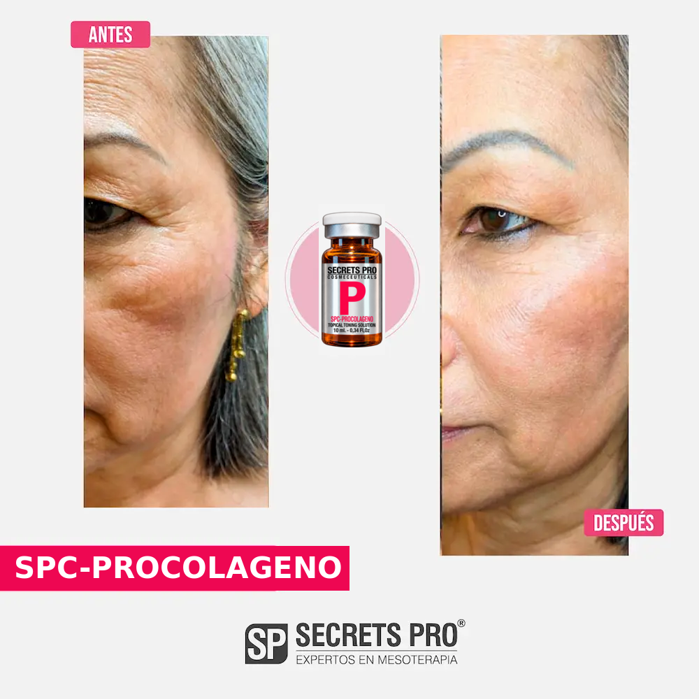 Evidencias 44 Registro de antes y después asociado a SPC-PROCOLAGENO, caso 44