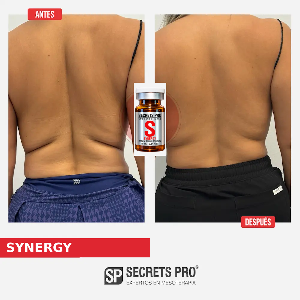Evidencias 2 Registro de antes y después asociado a SYNERGY, caso 2