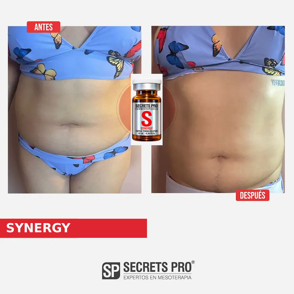 Evidencias 3 Registro de antes y después asociado a SYNERGY, caso 3
