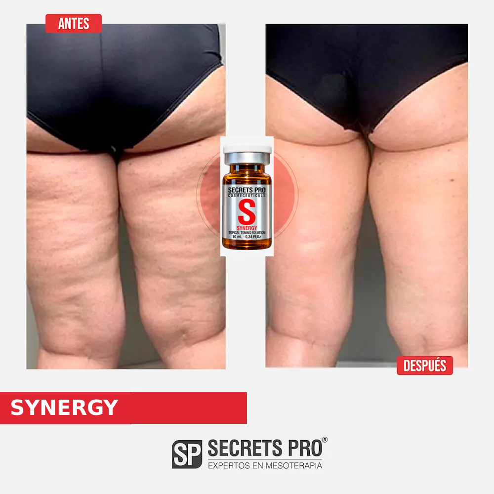 Evidencias 4 Registro de antes y después asociado a SYNERGY, caso 4
