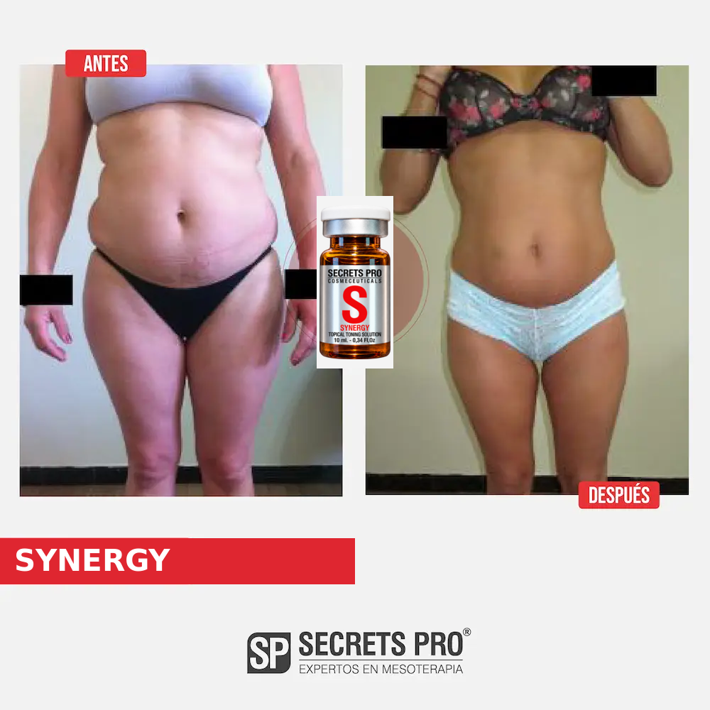 Evidencias 5 Registro de antes y después asociado a SYNERGY, caso 5