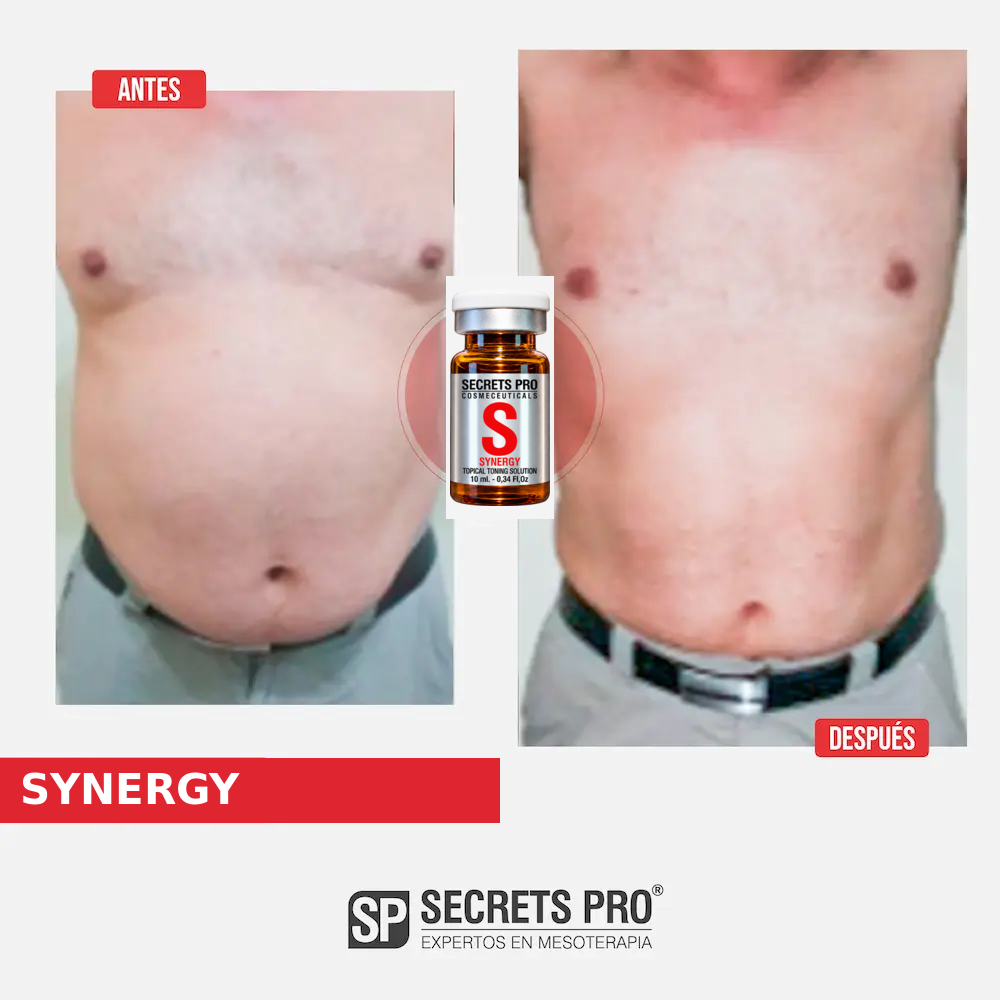 Evidencias 6 Registro de antes y después asociado a SYNERGY, caso 6