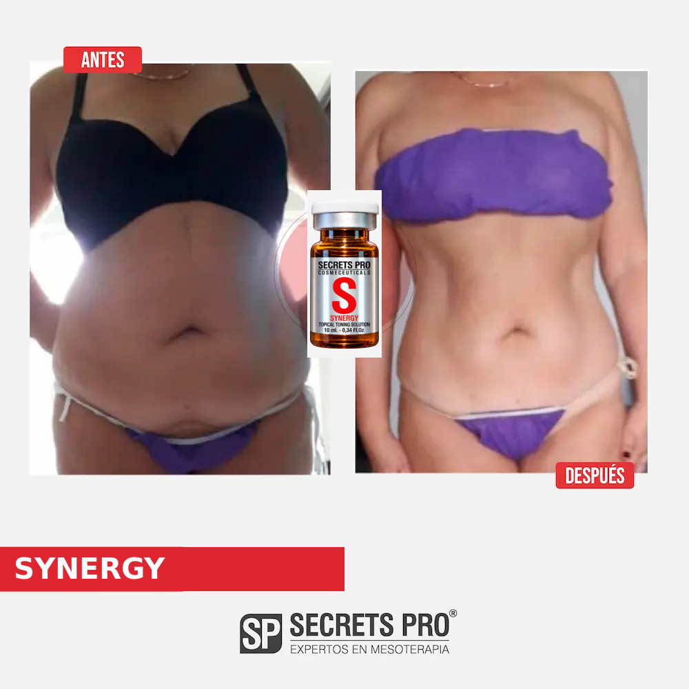 Evidencias 7 Registro de antes y después asociado a SYNERGY, caso 7
