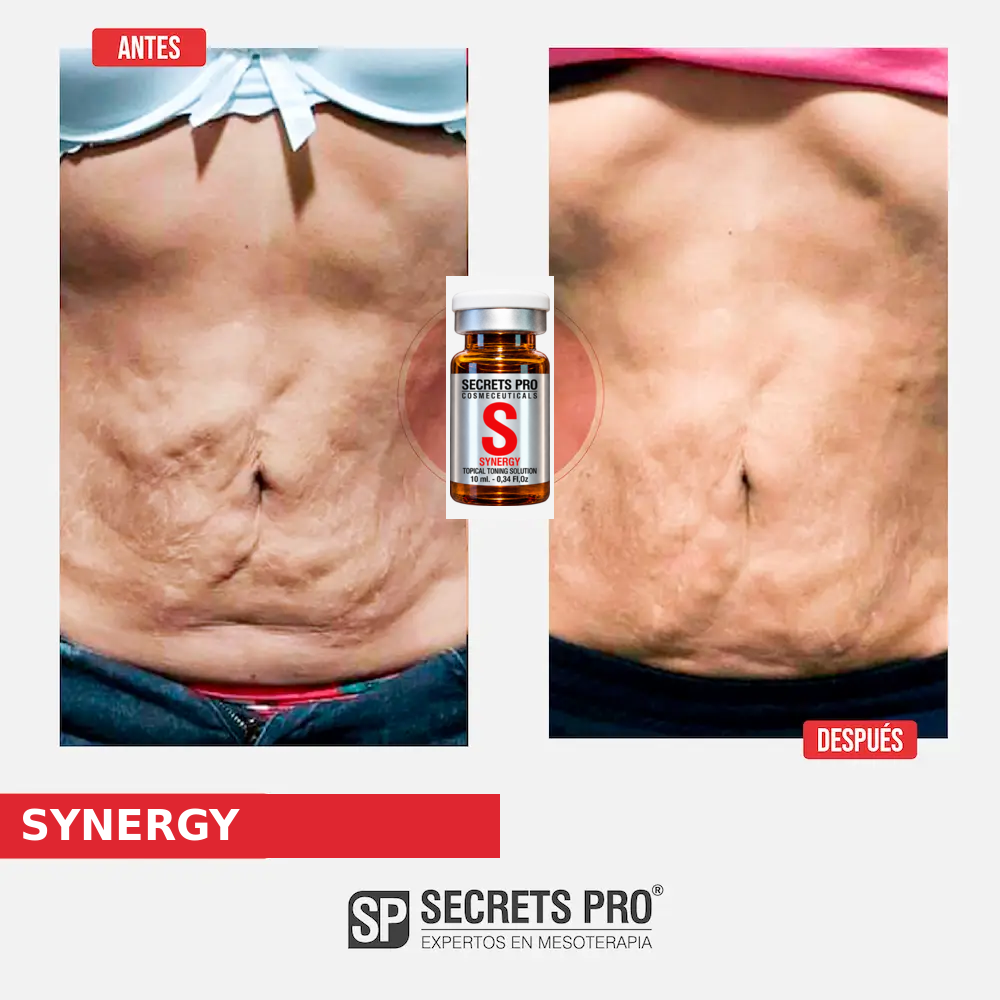 Evidencias 8 Registro de antes y después asociado a SYNERGY, caso 8
