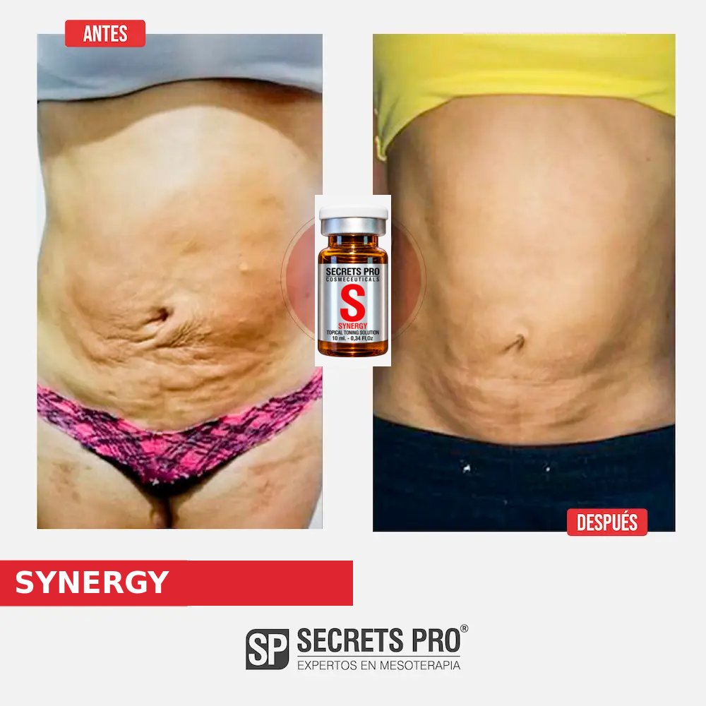 Evidencias 9 Registro de antes y después asociado a SYNERGY, caso 9