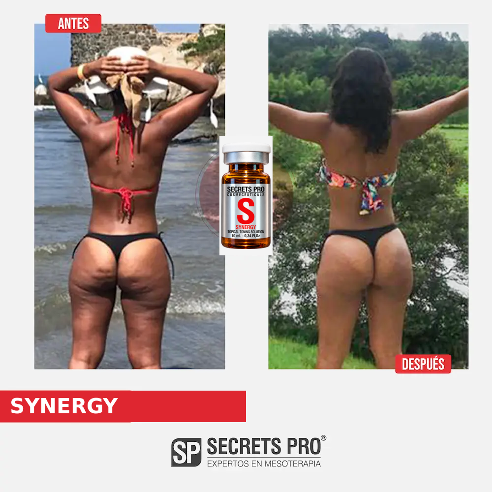 Evidencias 10 Registro de antes y después asociado a SYNERGY, caso 10