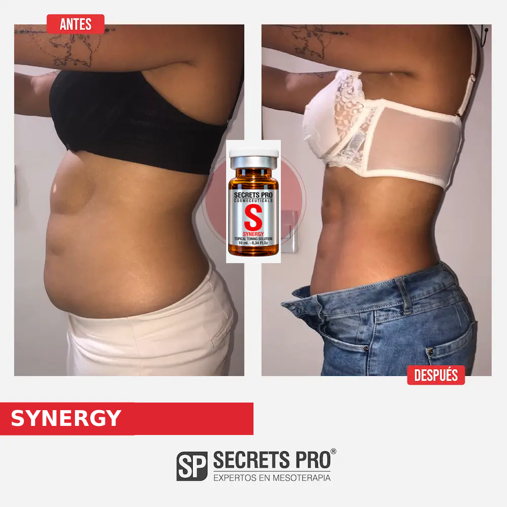Evidencias 11 Registro de antes y después asociado a SYNERGY, caso 11