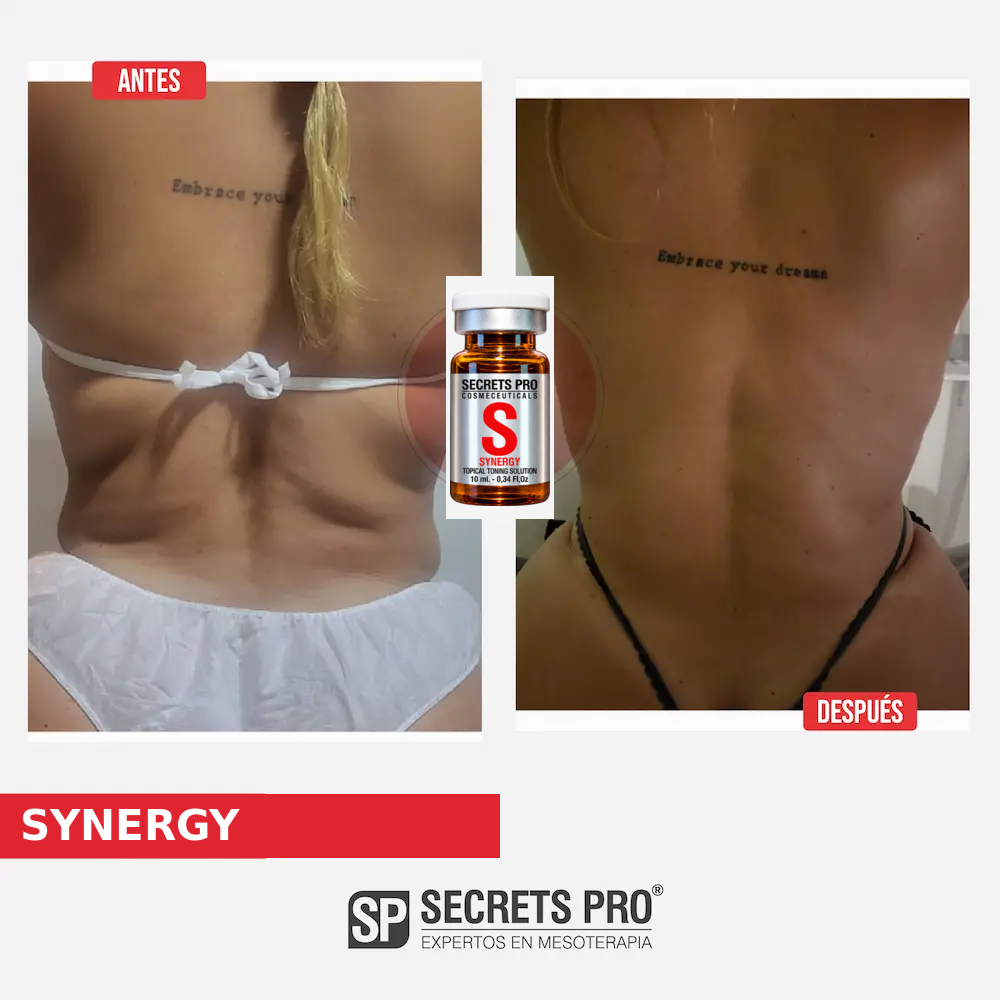 Evidencias 12 Registro de antes y después asociado a SYNERGY, caso 12