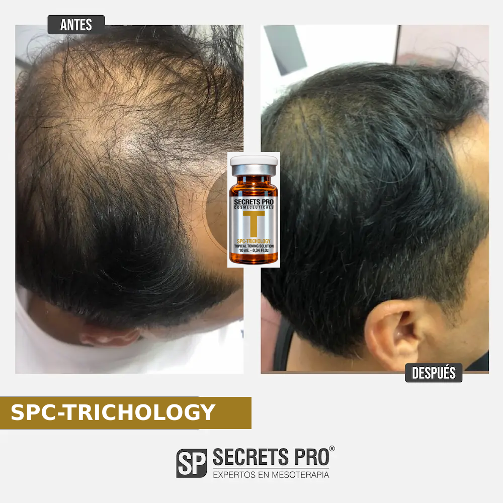 Evidencias 55 Registro de antes y después asociado a SPC-TRICHOLOGY, caso 55