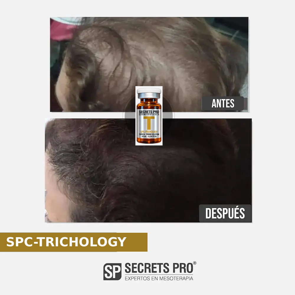 Evidencias 58 Registro de antes y después asociado a SPC-TRICHOLOGY, caso 58