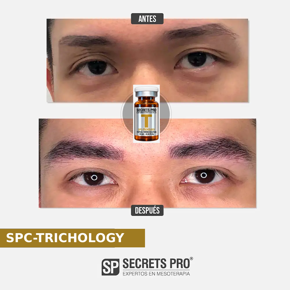Evidencias 60 Registro de antes y después asociado a SPC-TRICHOLOGY, caso 60