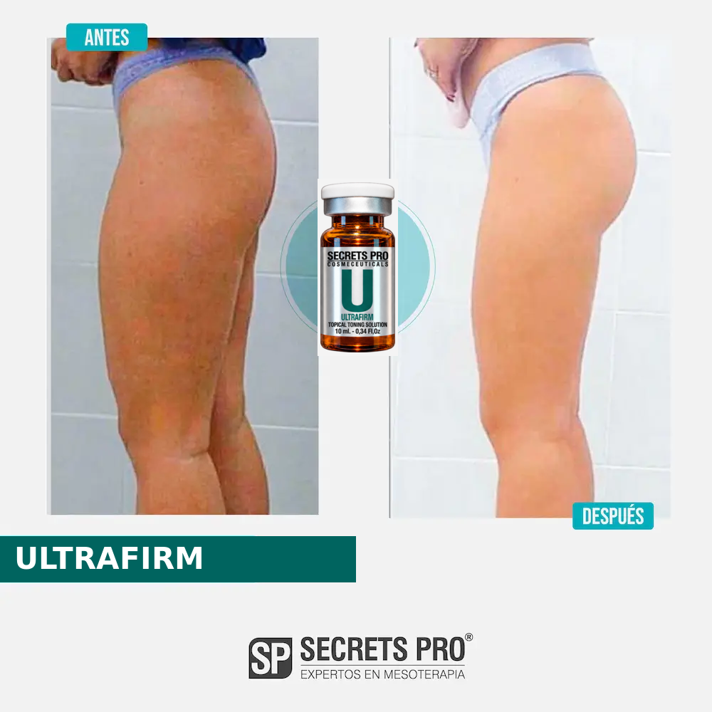 Evidencias 34 Registro de antes y después asociado a ULTRAFIRM, caso 34