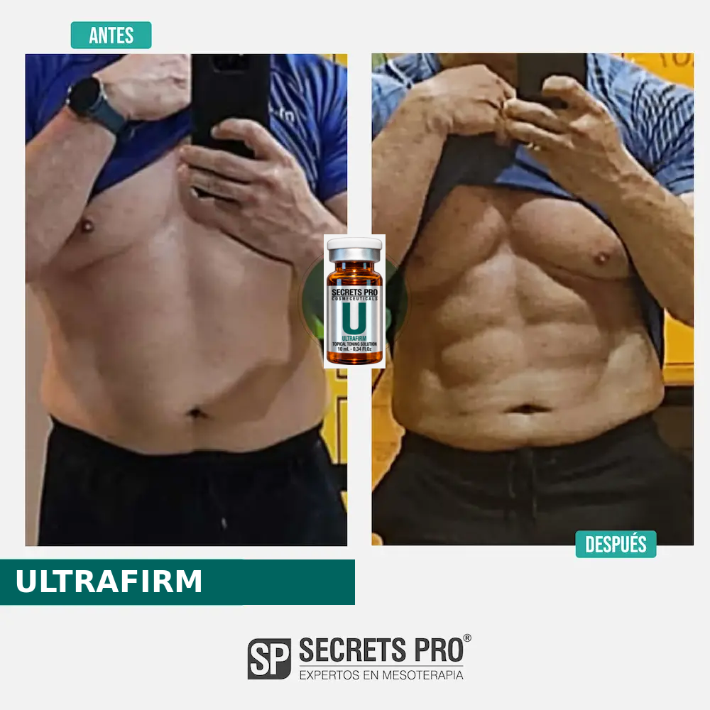 Evidencias 36 Registro de antes y después asociado a ULTRAFIRM, caso 36