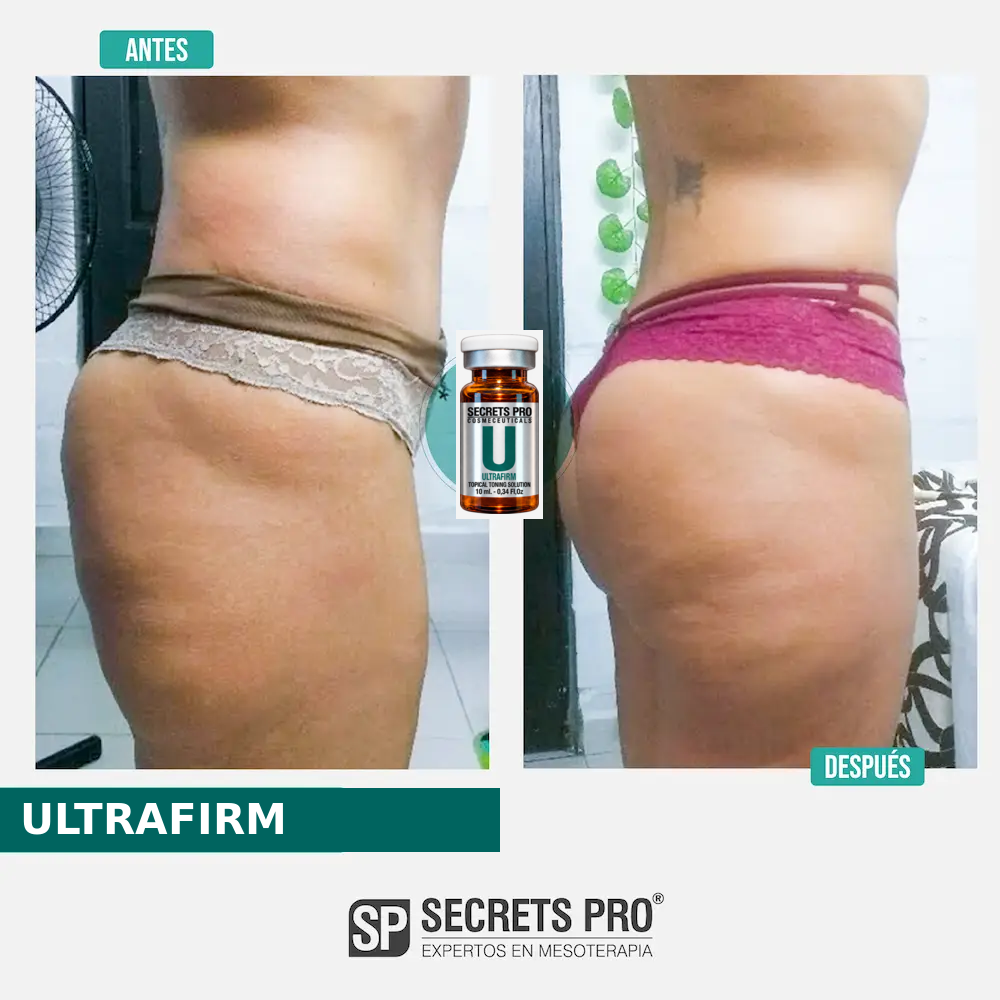 Evidencias 37 Registro de antes y después asociado a ULTRAFIRM, caso 37