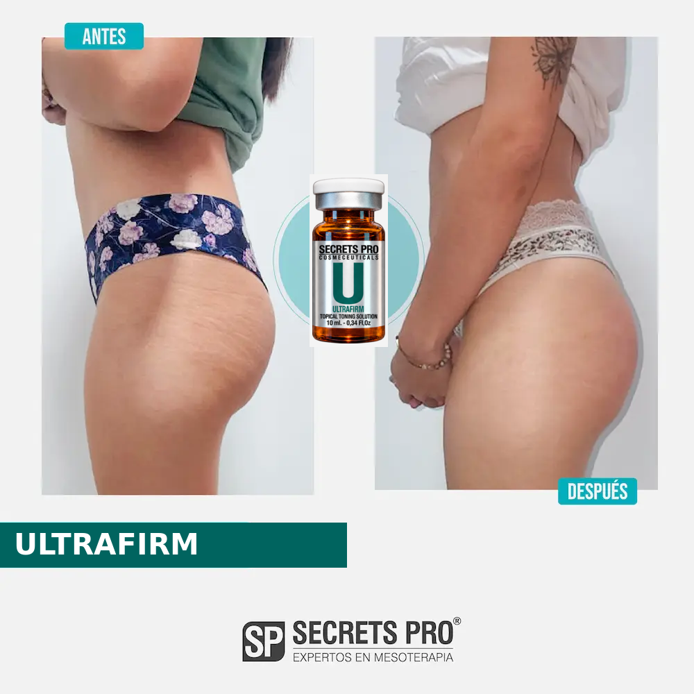 Evidencias 40 Registro de antes y después asociado a ULTRAFIRM, caso 40