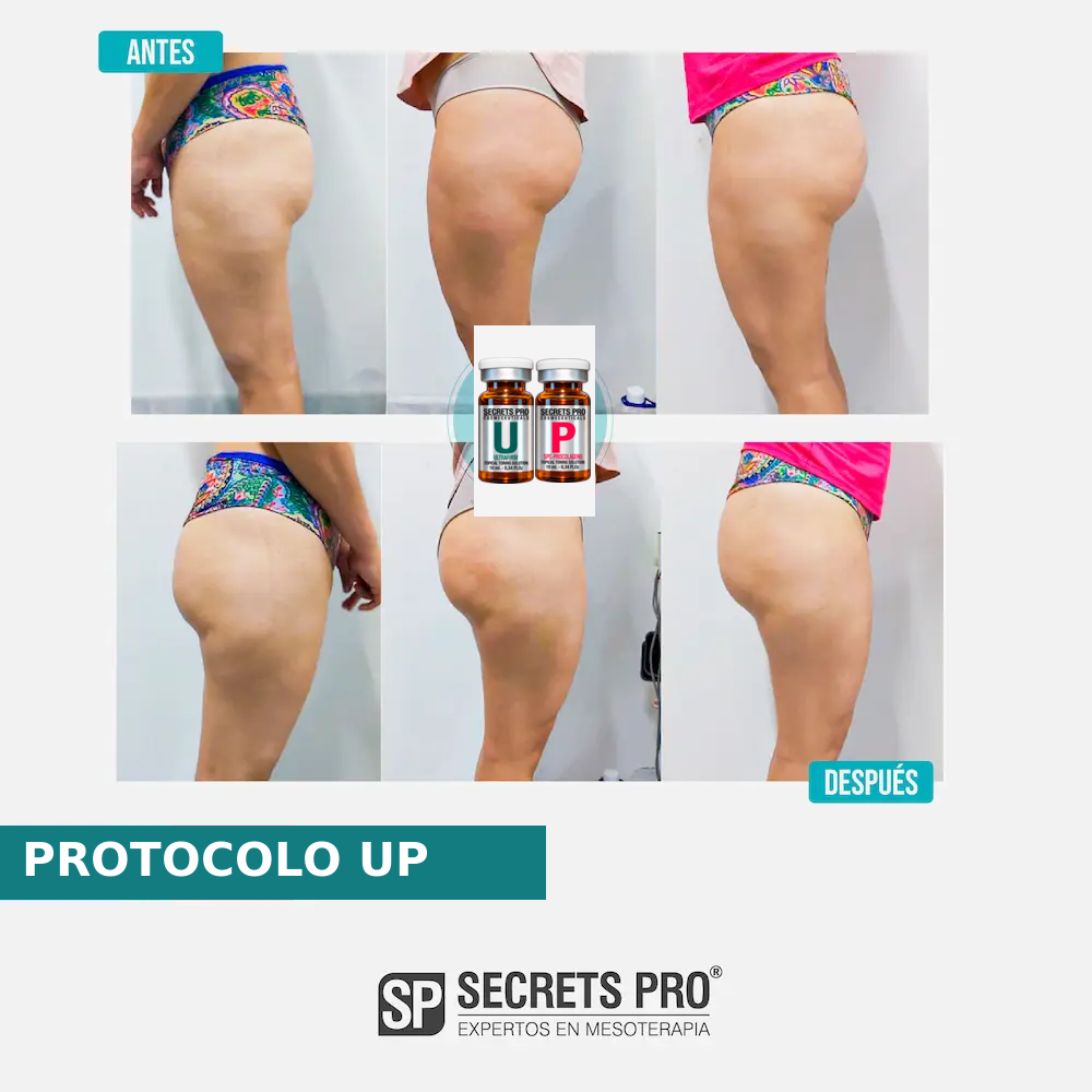 Evidencias 46 Registro de antes y después asociado a PROTOCOLO UP, caso 46