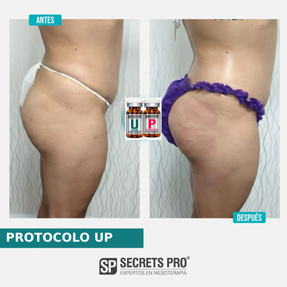 Evidencias 49 Registro de antes y después asociado a PROTOCOLO UP, caso 49