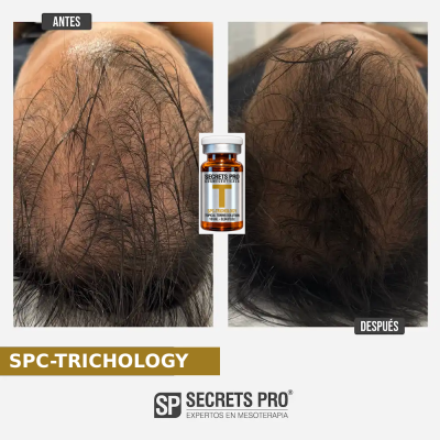 Registro de antes y después asociado a SPC-TRICHOLOGY, caso 50